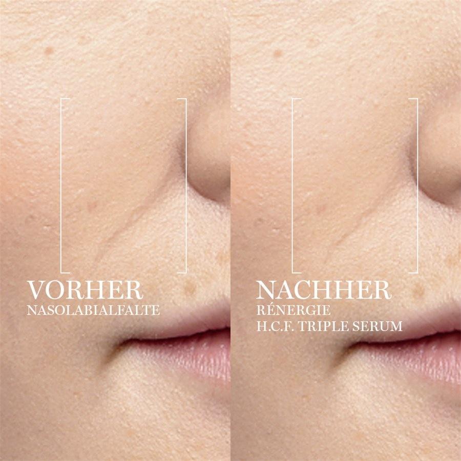 Lancôme Siero Rénergie H.C.F. Triple Serum 2025
