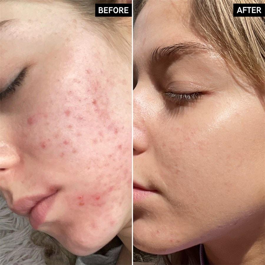 The INKEY List Sieri Niacinamide Serum Saldi Di Fabbrica