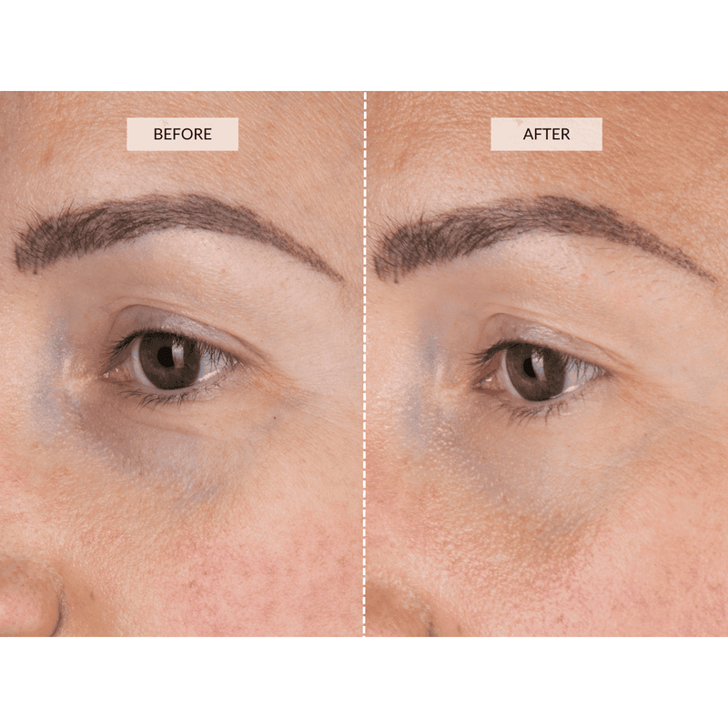 CurrentBody Skin LED Eye Perfector I Più Venduti