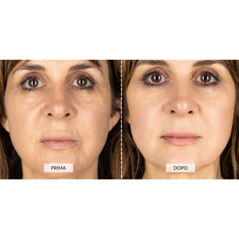 CurrentBody Skin Dispositivo a radiofrequenza per il viso RF Currentbody Skin Italia