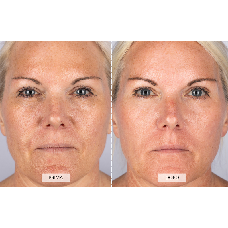 CurrentBody Skin Dispositivo a radiofrequenza per il viso RF Currentbody Skin Italia