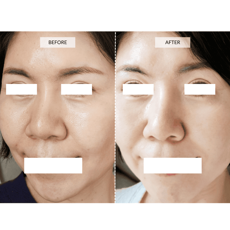 CurrentBody Skin Maschera viso LED 4-in-1 con mappatura a zone Currentbody Skin Vendita