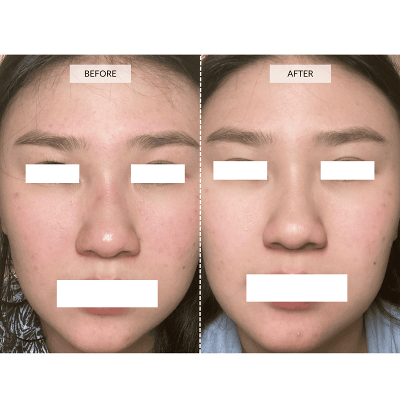 CurrentBody Skin Maschera viso LED 4-in-1 con mappatura a zone Currentbody Skin Vendita