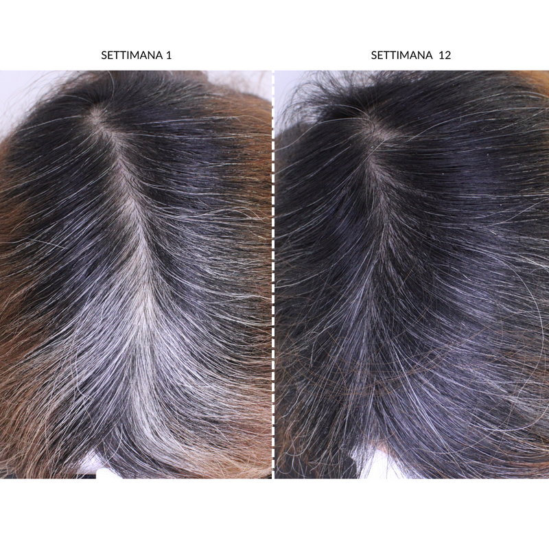 CurrentBody Skin Dispositivo LED Per la Ricrescita dei Capelli Spedizione Gratuita