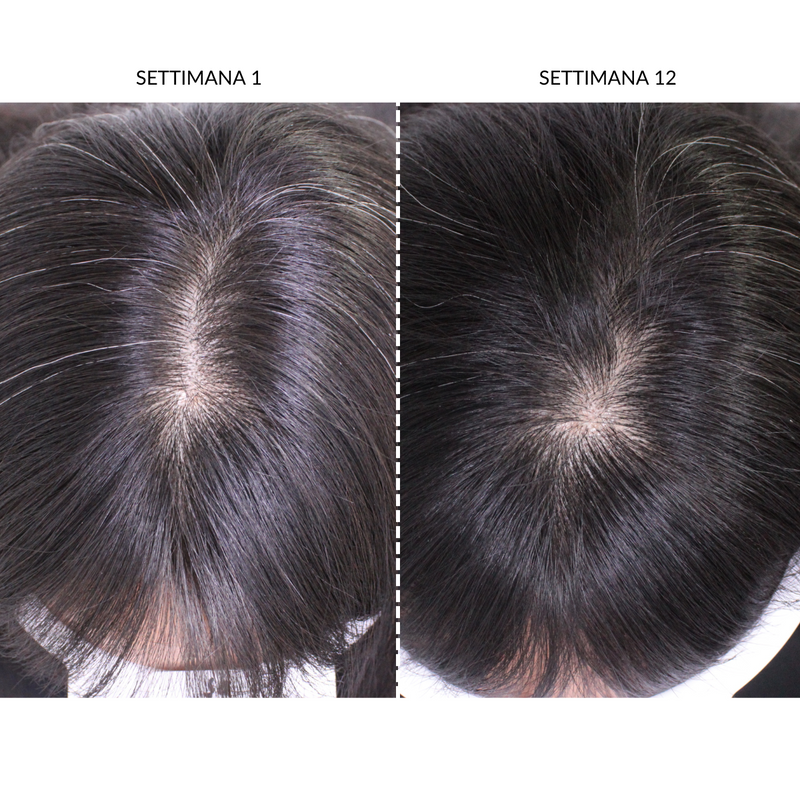 CurrentBody Skin Dispositivo LED Per la Ricrescita dei Capelli Spedizione Gratuita