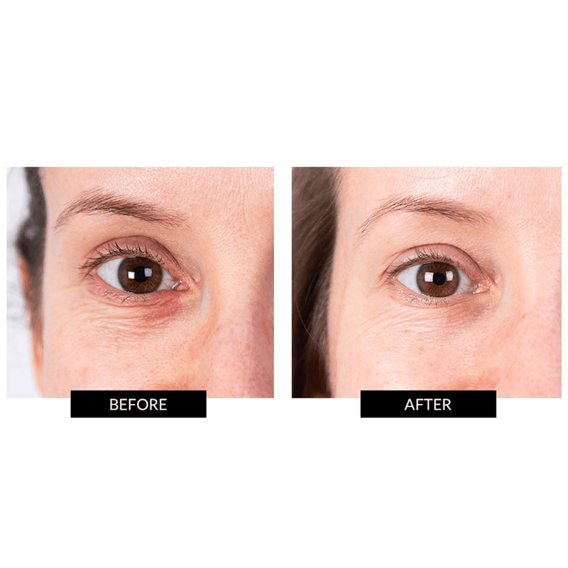 CurrentBody Skin LED Eye Perfector & 5 Eye Hydrogel Masks (del valore di 249€) 2025