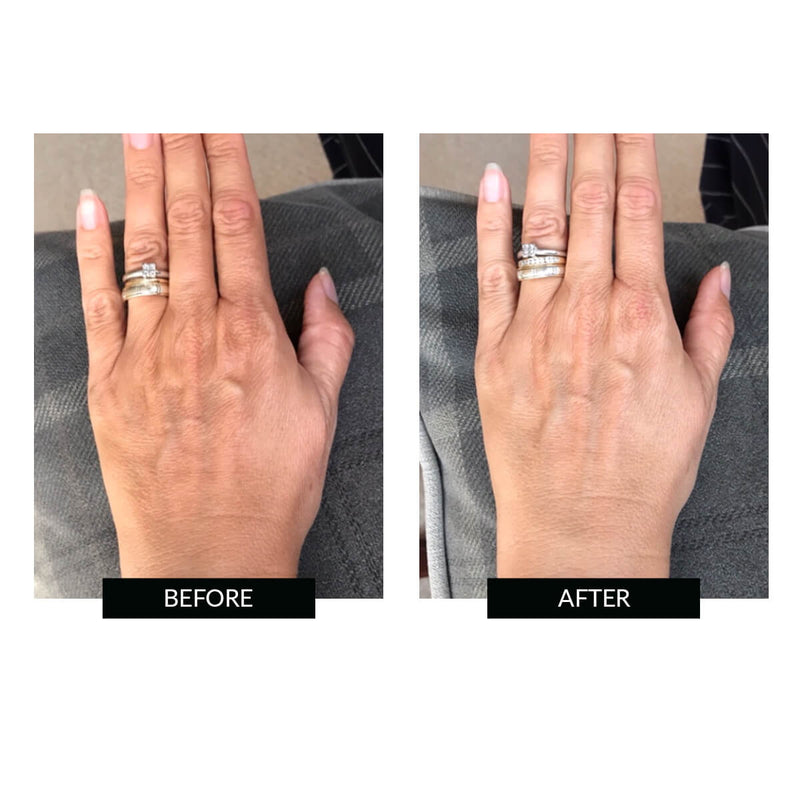 CurrentBody Skin Hand perfector LED Nuovo
