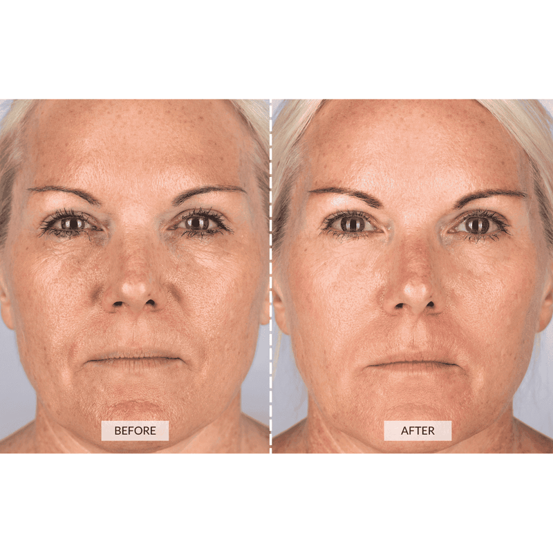 CurrentBody Skin Dispositivo a radiofrequenza RF x Sonia Sélaire Italia