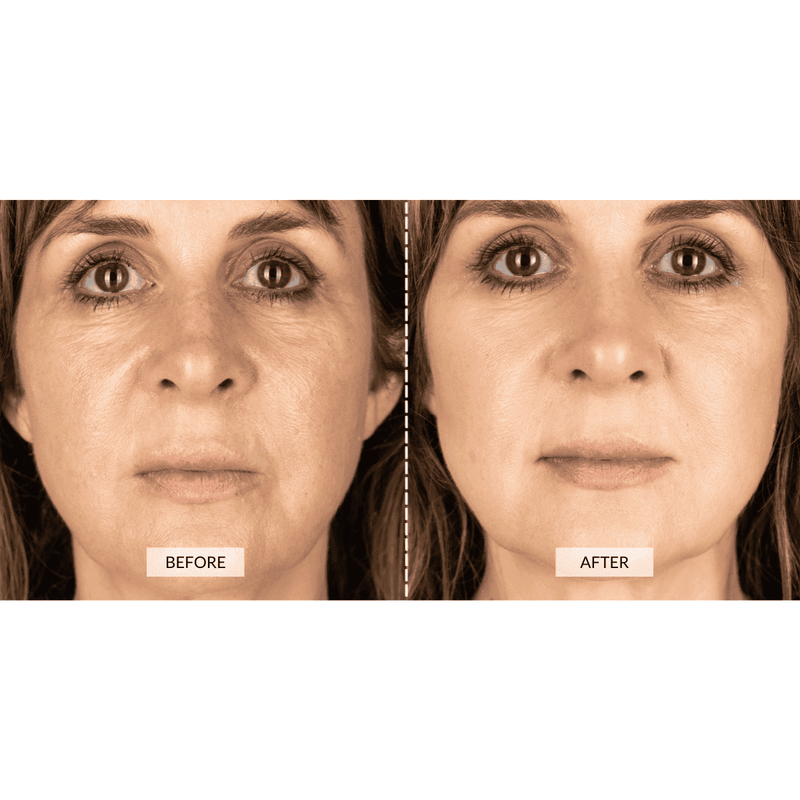 CurrentBody Skin Dispositivo a radiofrequenza RF x Sonia Sélaire Italia