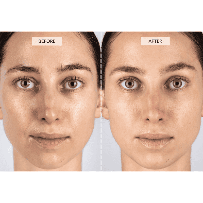 CurrentBody Skin Set Regalo Beauty LED Sconto