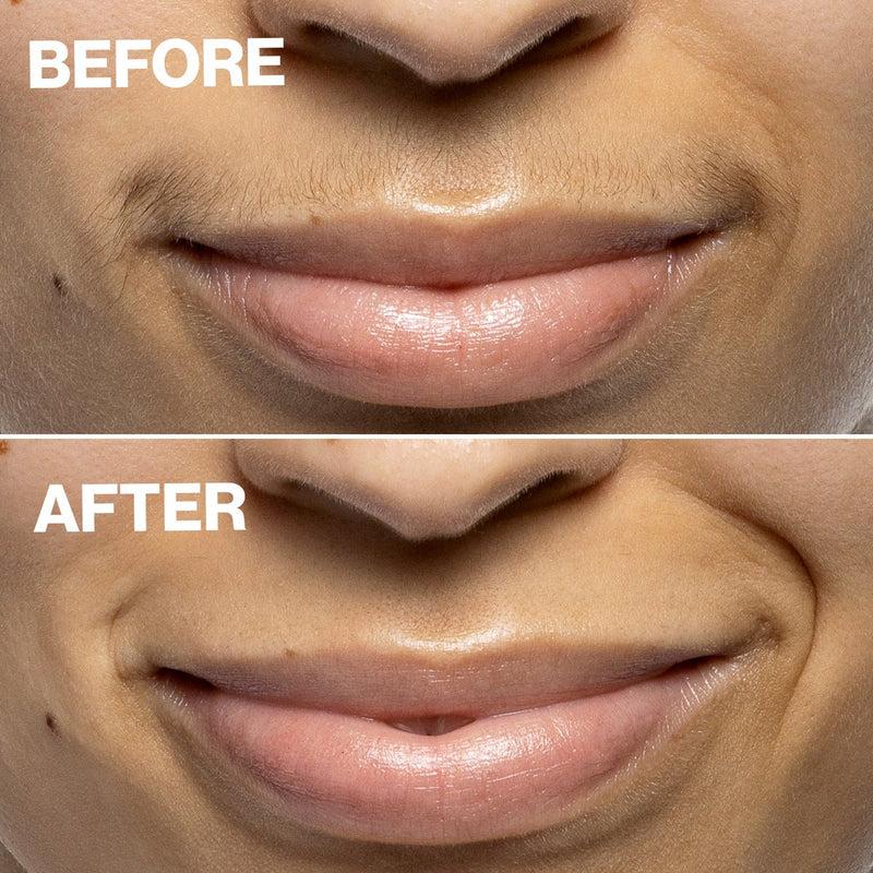 DERMAFLASH Dispositivo di Epilazione Mini Precision Peach Fuzz Hotsell