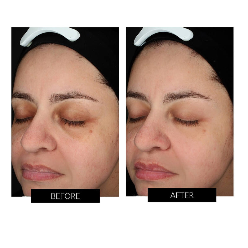 FAQ Primer al Miele di Manuka P1 (30ml) Negozi Online