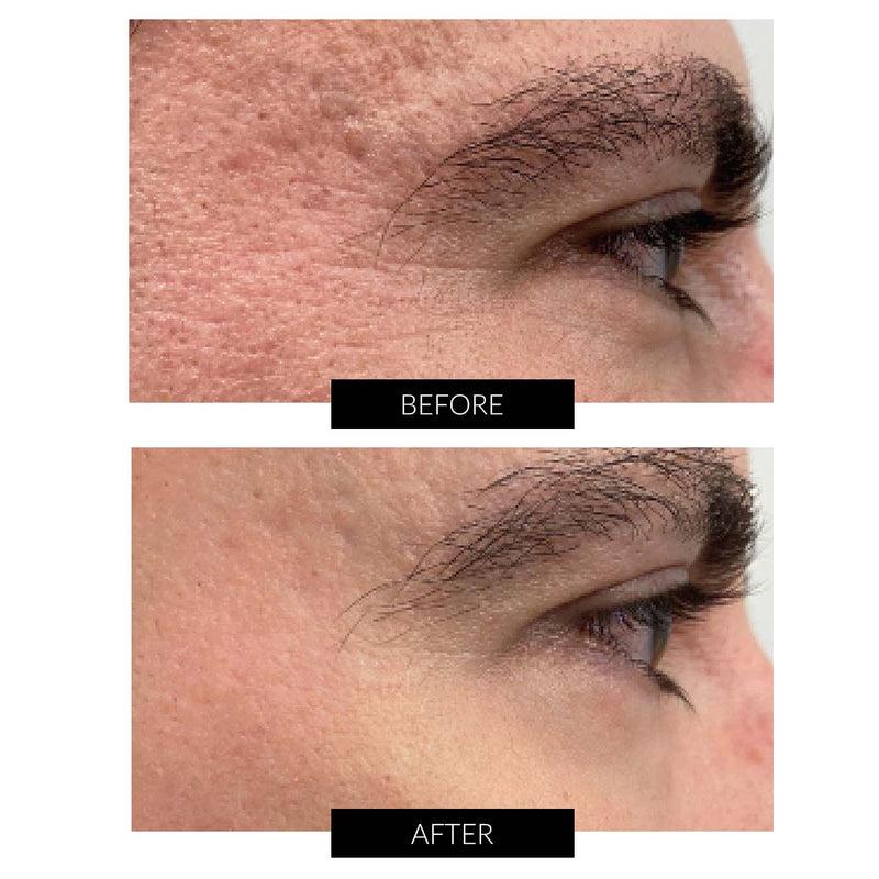 Dr Levy Set Stem Cell Miracle Trial (del valore di 495€) Consegna Veloce