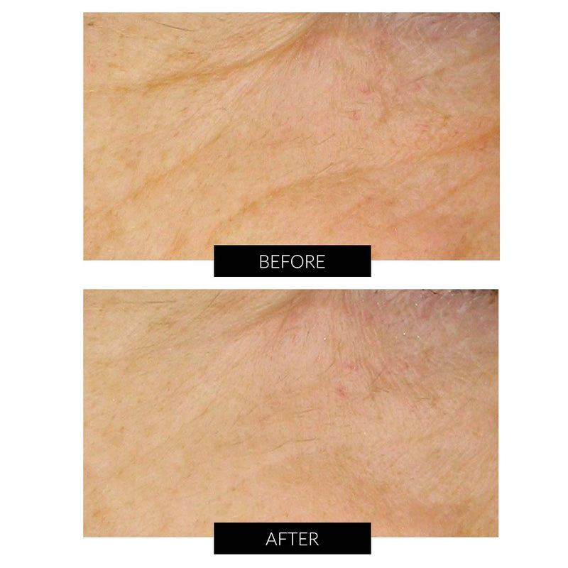 Dr Levy Set Stem Cell Miracle Trial (del valore di 495€) Consegna Veloce