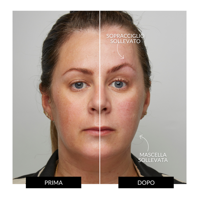 CurrentBody Skin Offers Dispositivo Tonificante Facciale ZIIP HALO Offerta Saldi Di Fabbrica