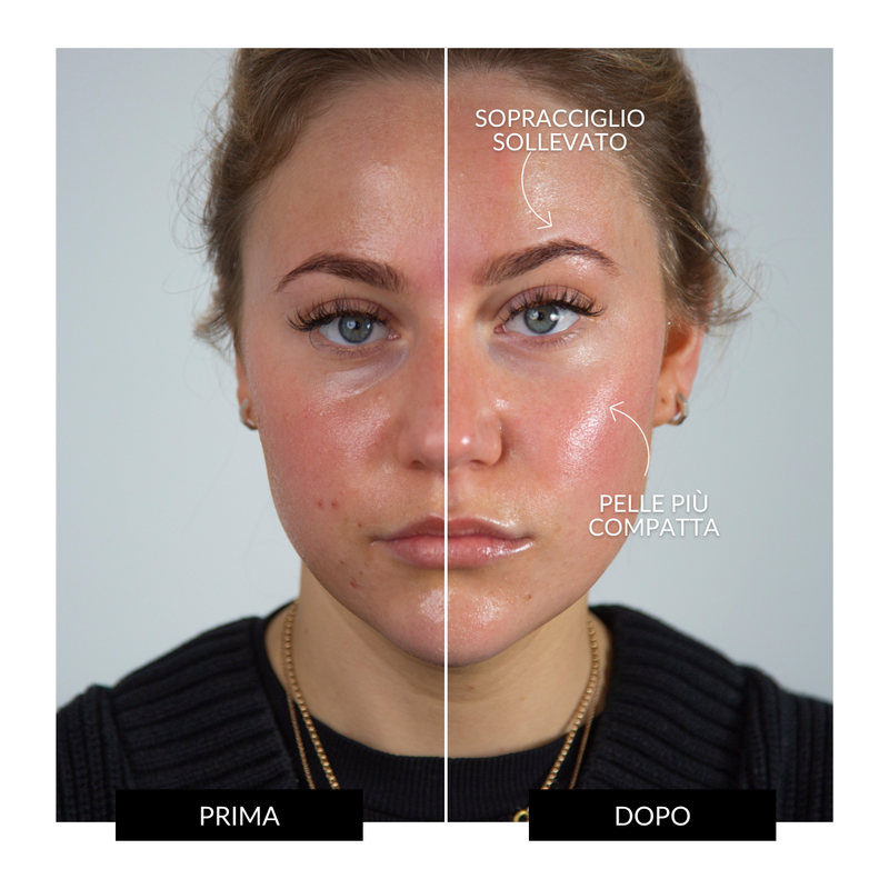 CurrentBody Skin Offers Dispositivo Tonificante Facciale ZIIP HALO Offerta Saldi Di Fabbrica