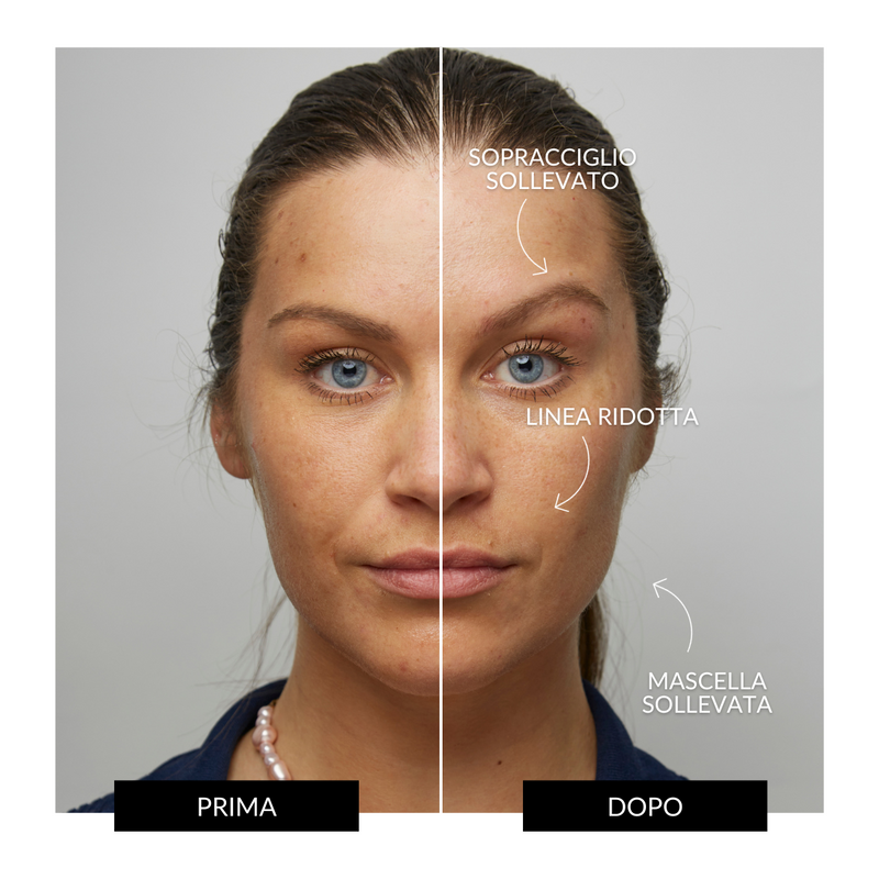 CurrentBody Skin Offers Dispositivo Tonificante Facciale ZIIP HALO Offerta Saldi Di Fabbrica