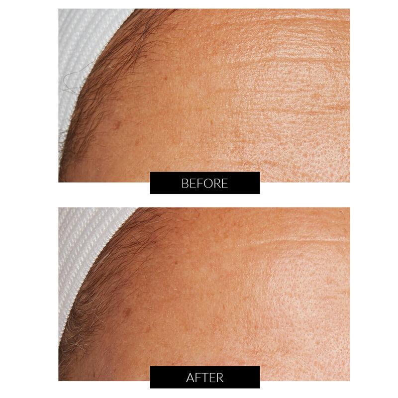 Lancer Skincare The Method: Nourish Normal-Combination Skin (50ml) Hotsell