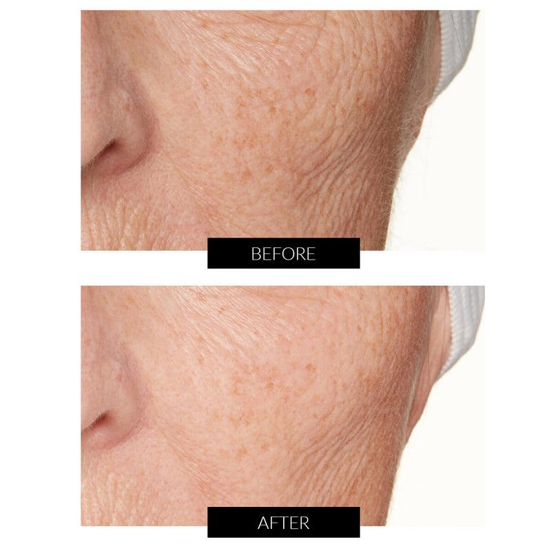 Lancer Skincare Olio Idratante Omega con Ferment Complex (30ml) I Più Venduti