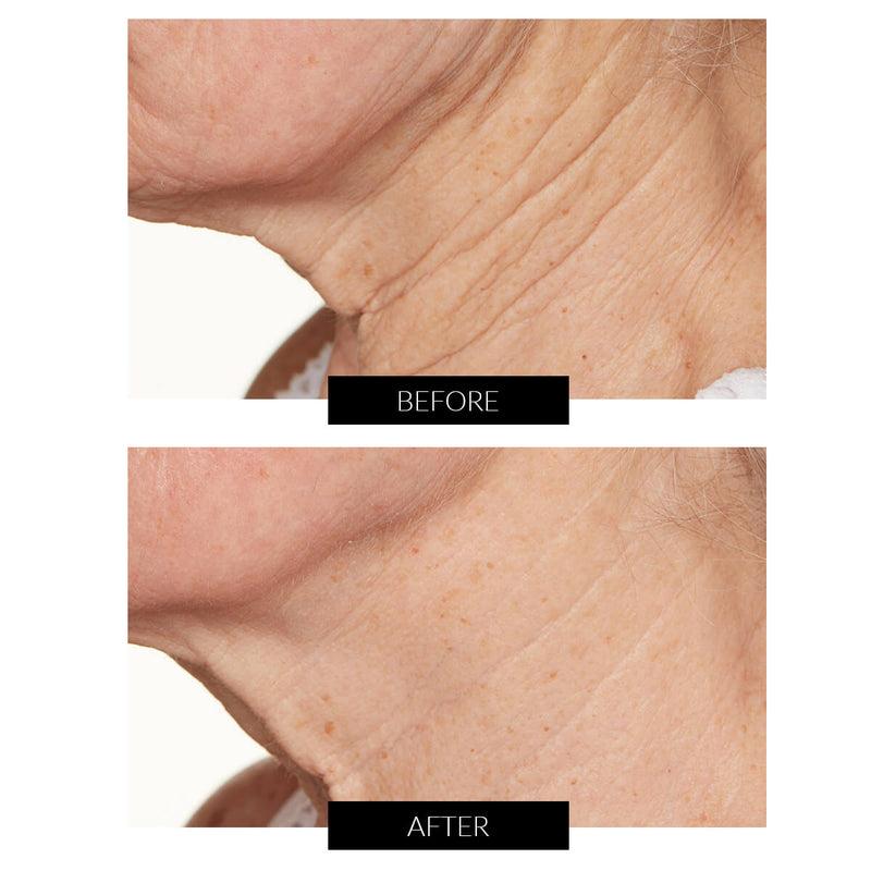 Lancer Skincare Trattamento Illuminante Advanced C (50ml) Moda